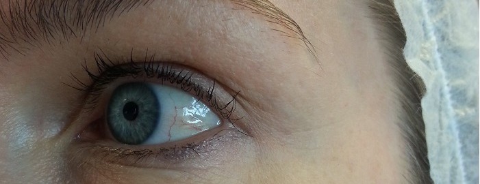 Eye eye...