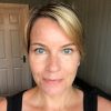 A Botox update and microneedling