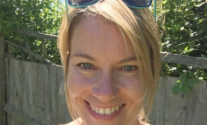 Post 40 beauty: what it's really like to have Botox