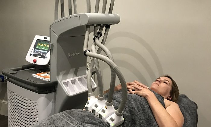 SculpSure body contouring at S-Thetics Clinic, Beaconsfield